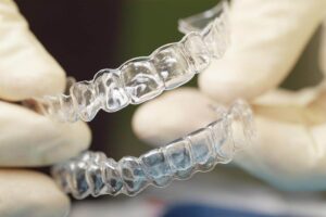 Khay niềng răng trong suốt được sản xuất bằng công nghệ in 3D trong nha khoa